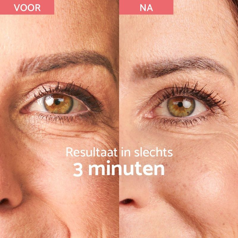 Remescar - Instant Rimpel Corrector - Oogcrème - 15ml - Anti Rimpel