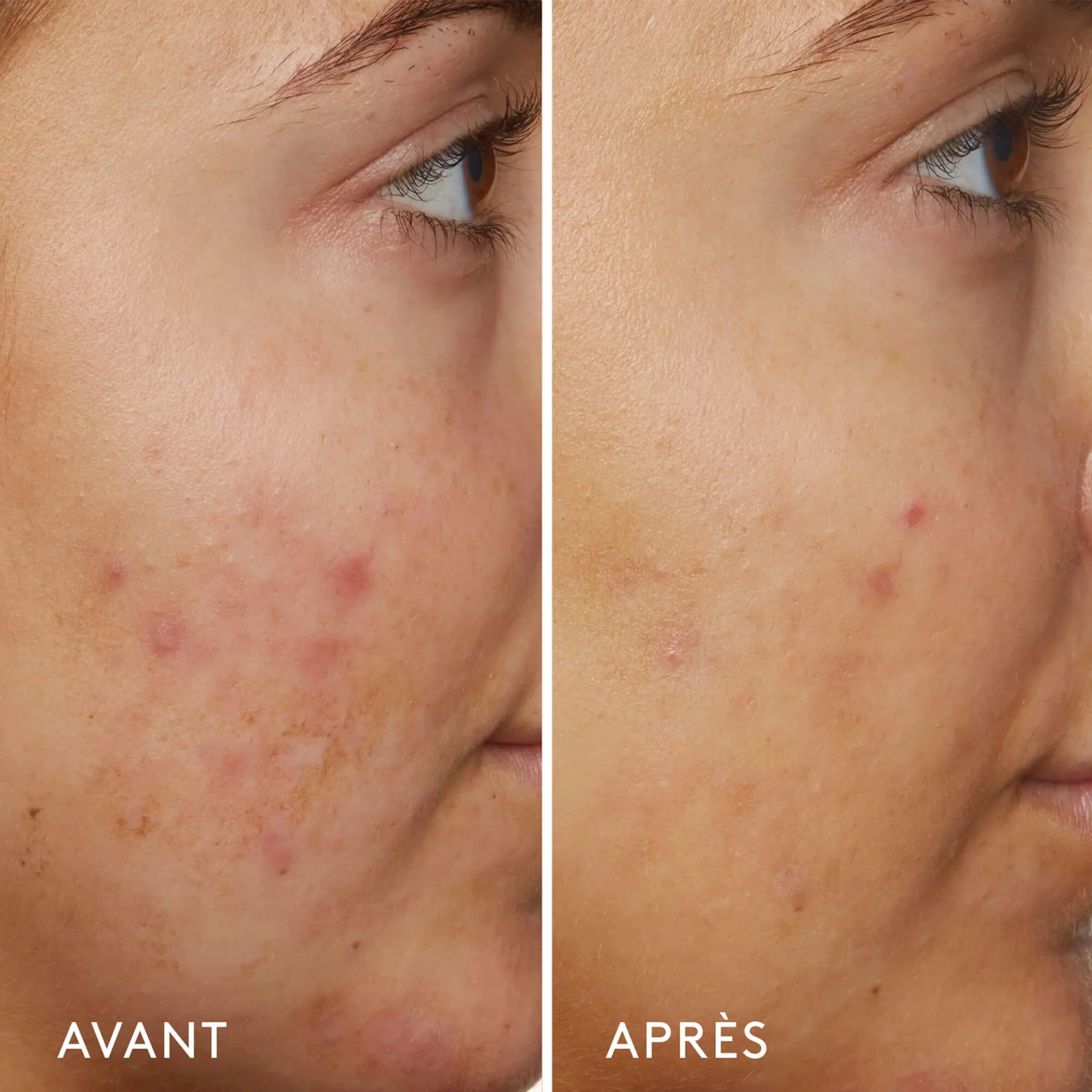 Sunday Riley B3 Nice 10% Niacinamide Sérum Rééquilibrant
