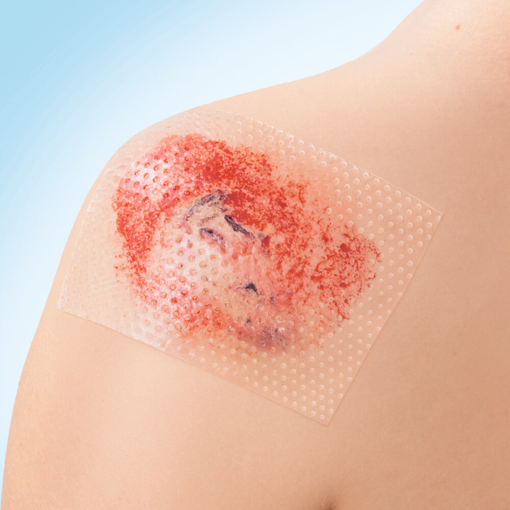 Leukoplast Cuticell® Contact Siliconen Wondcontactlaag 5 cm x 7,5 cm5 stuks