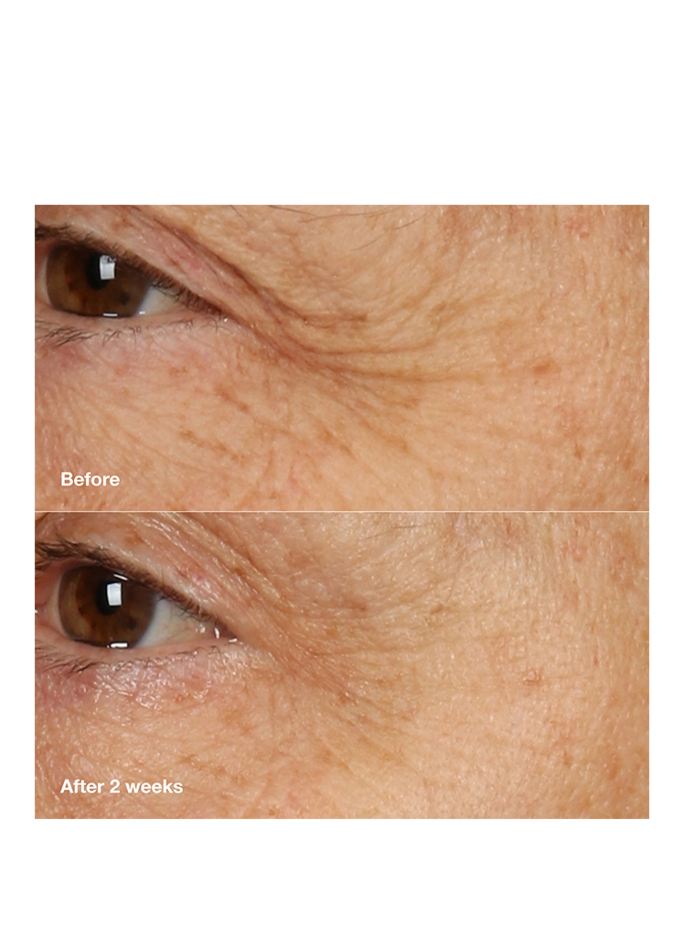 CLINIQUE SMART CLINICAL REPAIR