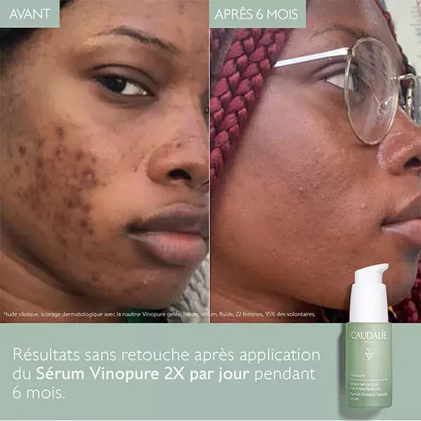 Sérum Anti-Imperfeições com Ácido Salicílico Vinopure da Caudalie 30ml