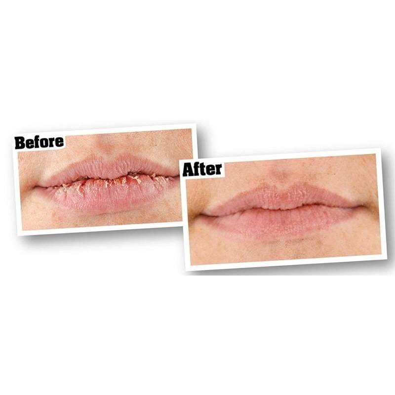 O'Keeffe's Lip Repair Stick SPF15 4,2 gr.