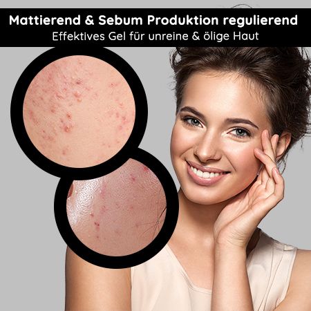 RAU Cosmetics Balancing & Mattifying Face Gel mit BHA - Mattierendes Gel für fettige, unreine Haut