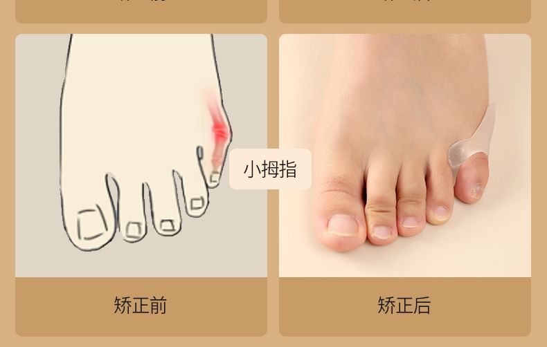 Caraboomie - Valgus Teen Correctie Brace (Diverse Ontwerpen)