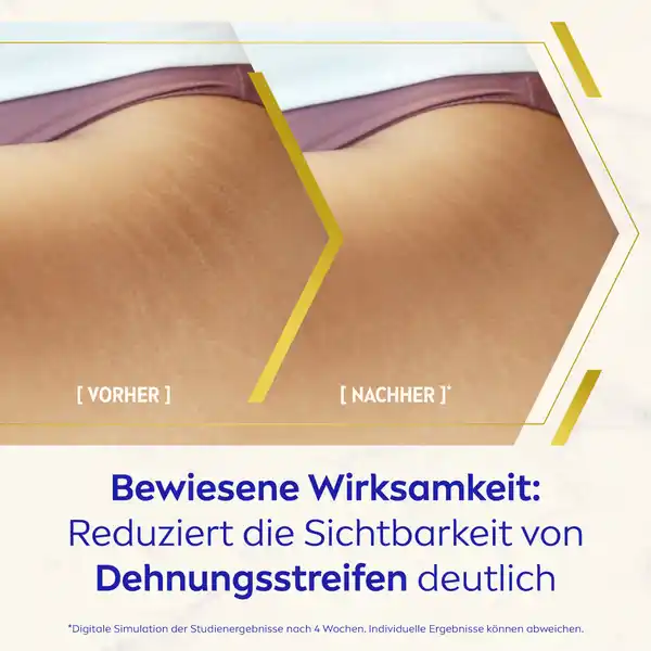 Body Öl-Serum Luminous630° Anti-Dehnungsstreifen
