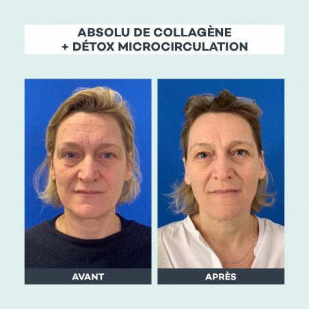 D-LAB NUTRICOSMETICS Detox microcirculation 3 mois