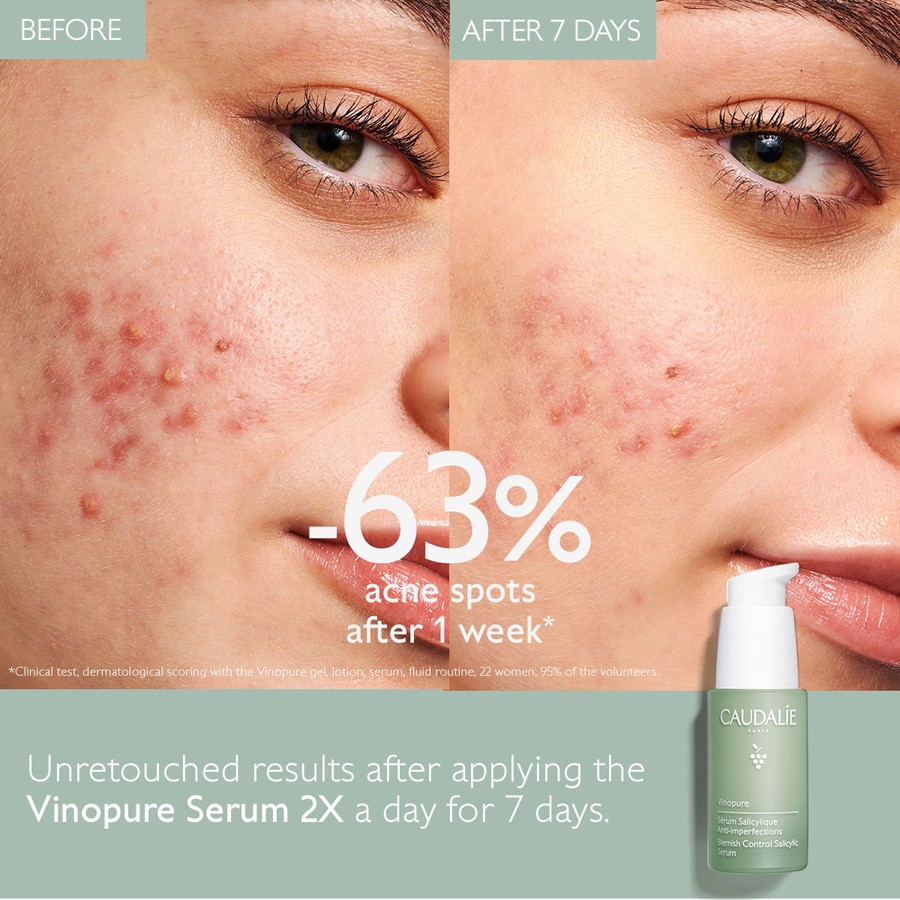 Caudalie Vinopure Blemish Control Infusion Serum 30ml