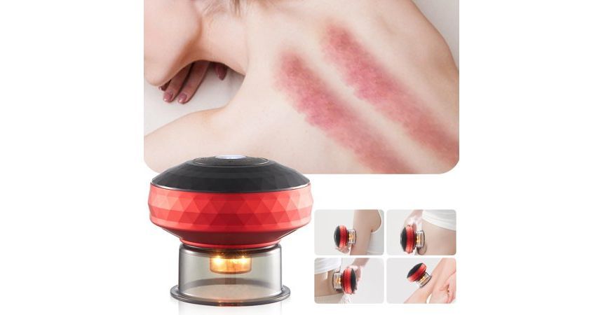 HOMTEC - Oplaadbare cuppingtherapie-massager