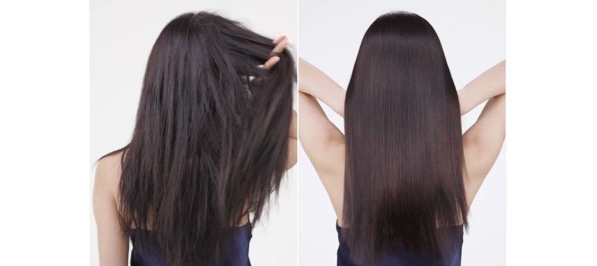 Dr.FORHAIR - UNOVE Ampulbehandeling zonder water