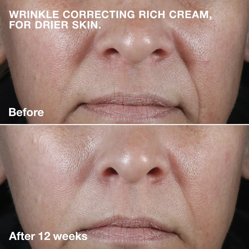 Clinique Smart Clinical Repair Wrinkle Correcting Face Cream Rich 50 ml