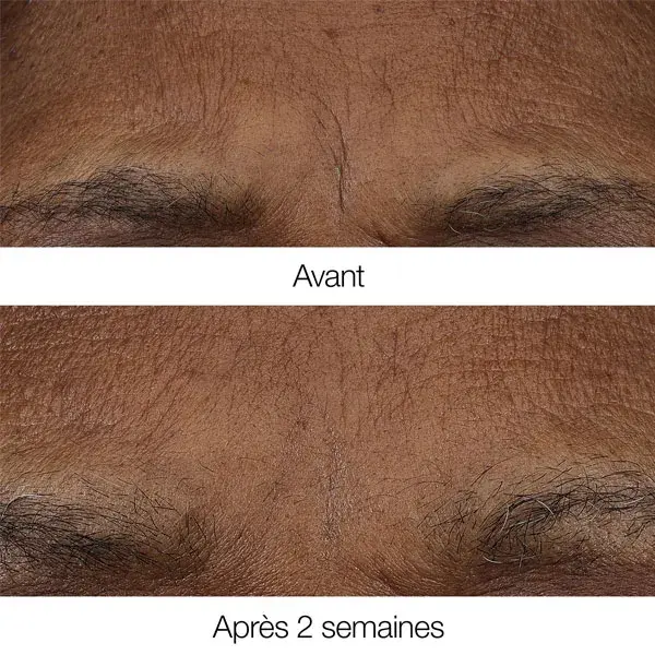 Clinique Smart Clinical Repair™ Bálsamo Retinóide Antirrugas para Uso Diurno/Noturno 3g