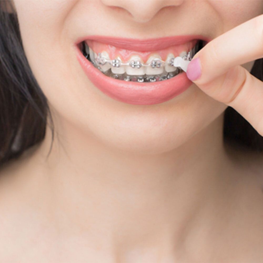 GUM® Ortho Wachs Mint