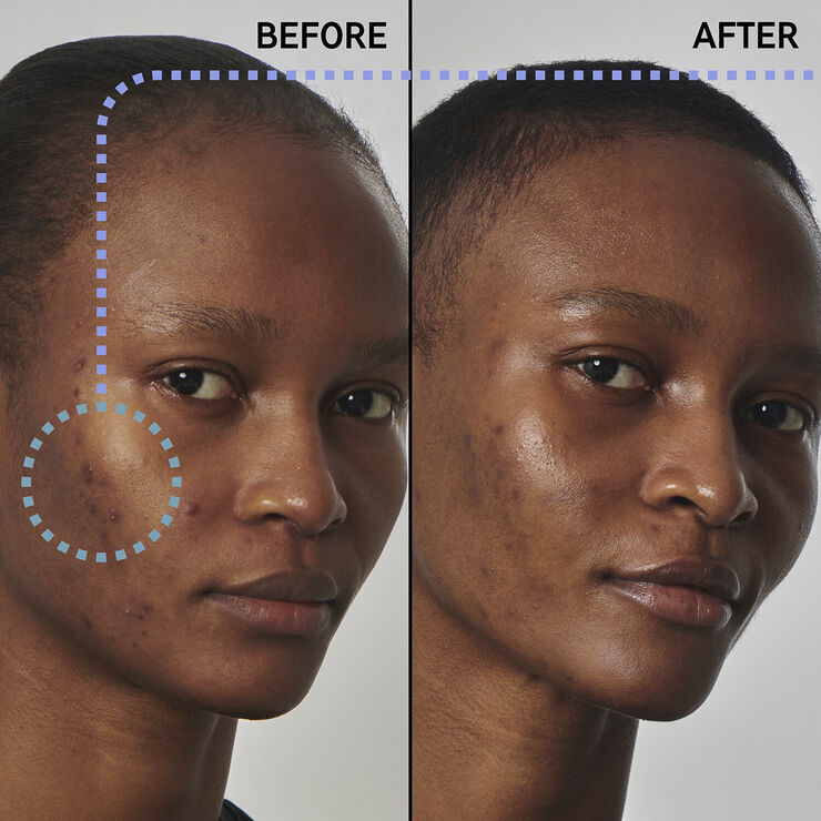 THE INKEY LIST Excess oil solution with 20% niacinamide - Face serum