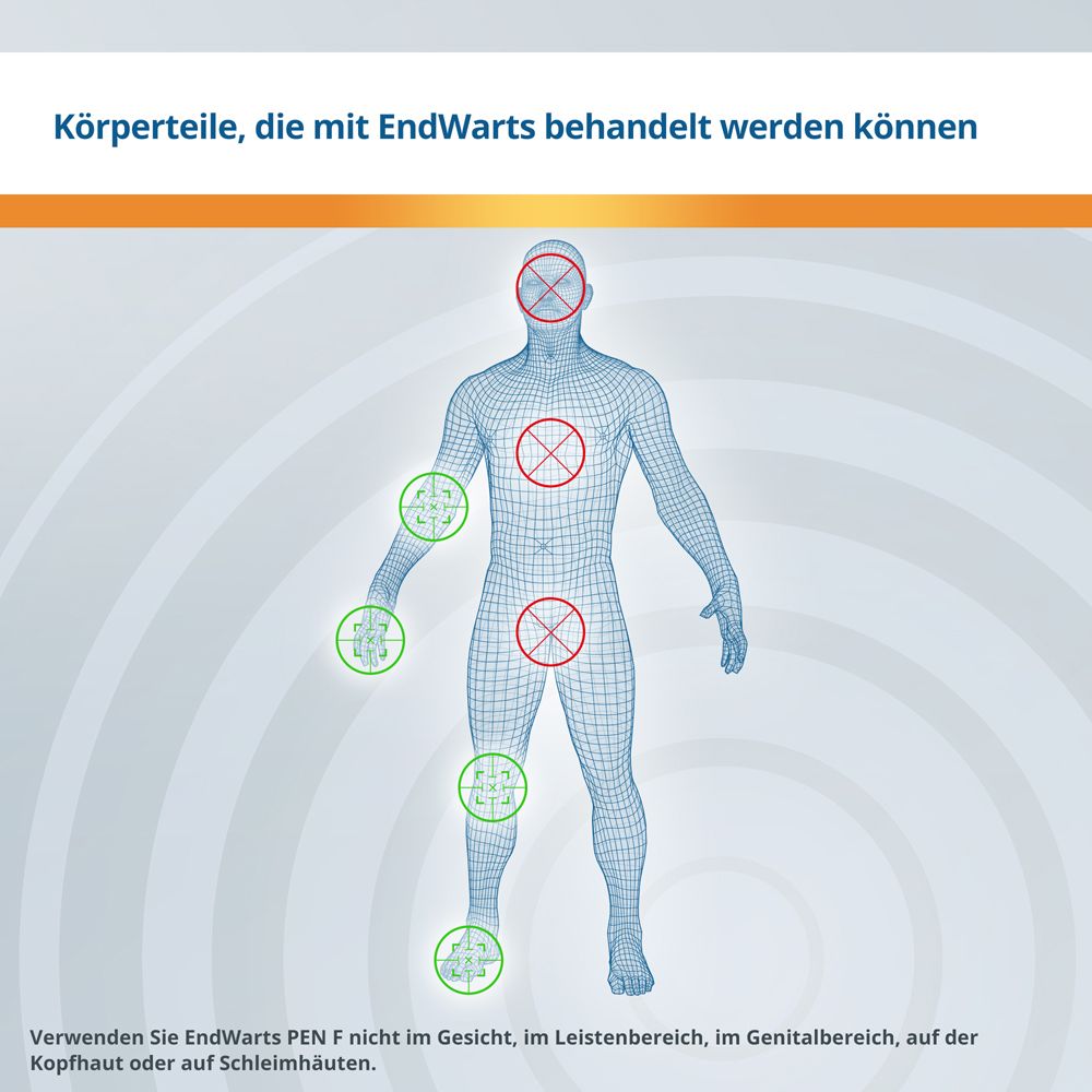 EndWarts PEN F: Warzen entfernen, Warzenentferner mit Ameisensäure, zur Warzenentfernung, Stift für ca. 30 Behandlungen