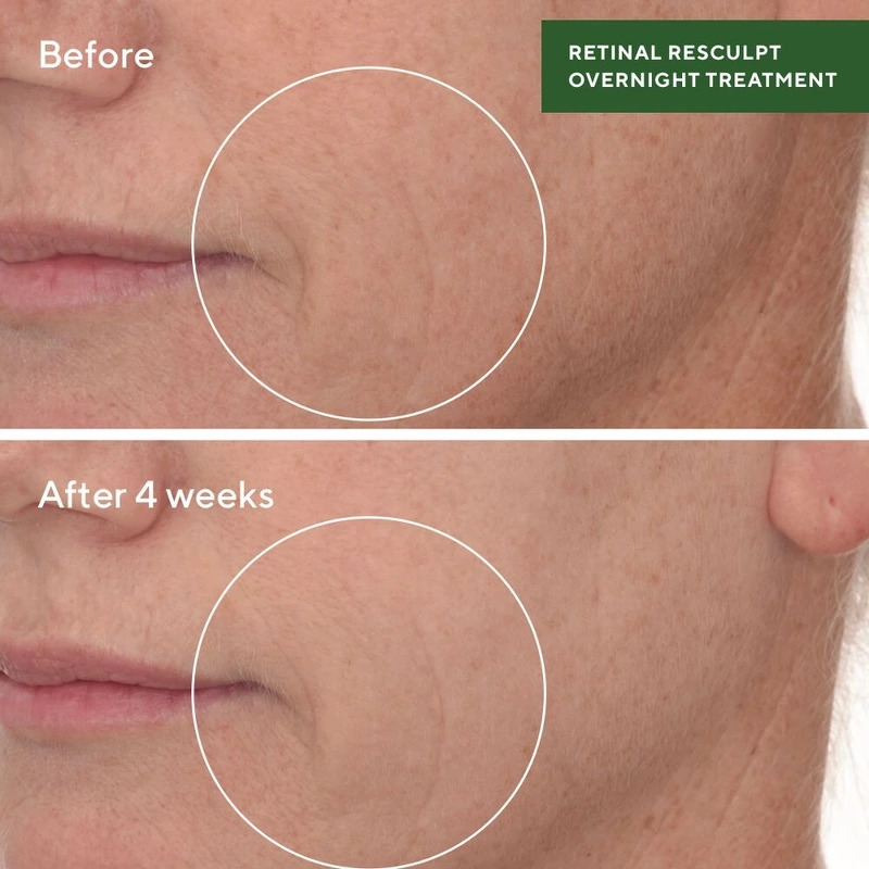 Murad Resurgence Retinal ReSculpt Overnight Treatment 30 ml