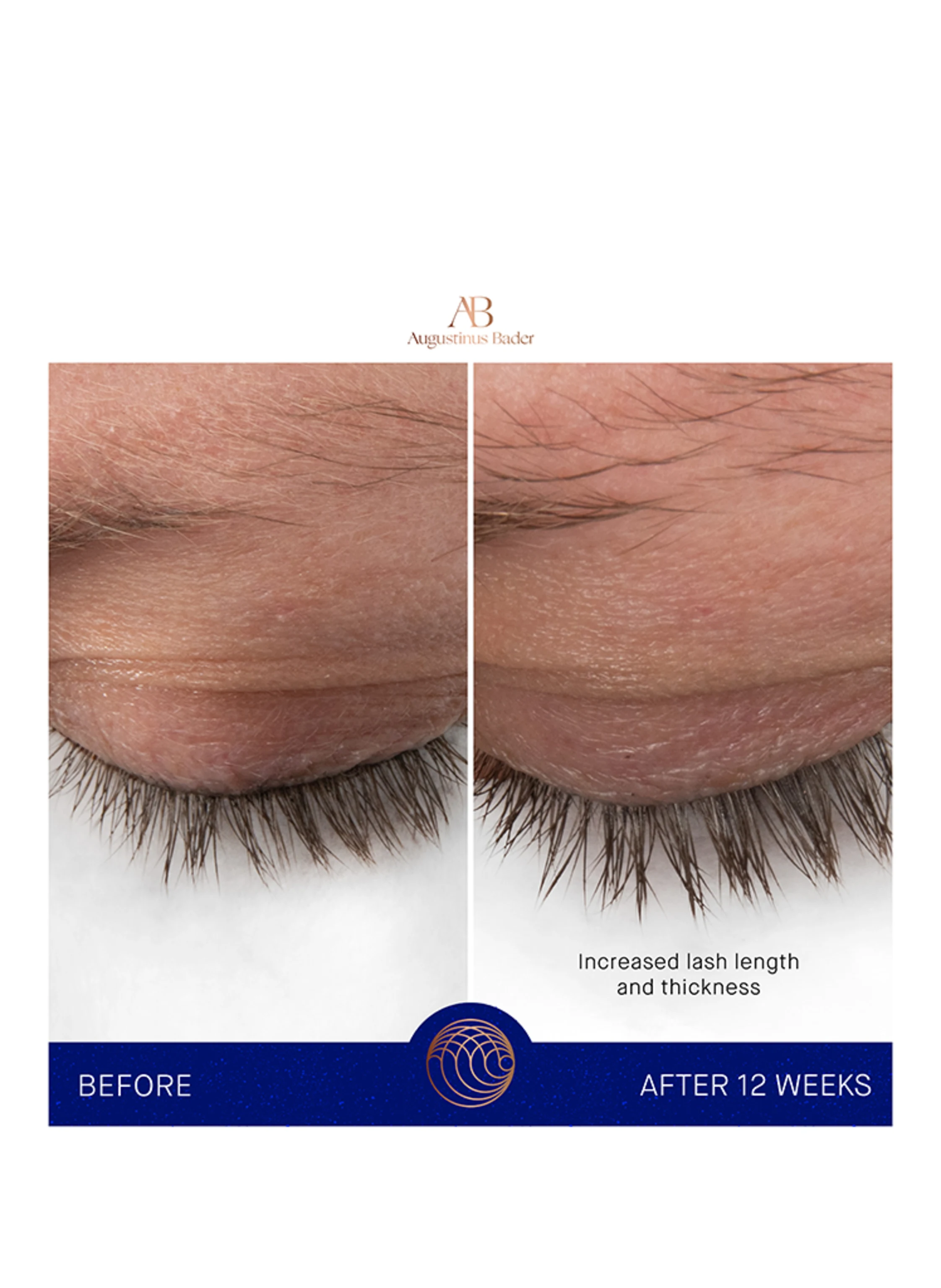 Augustinus Bader THE EYEBROW & LASH ENHANCING SERUM