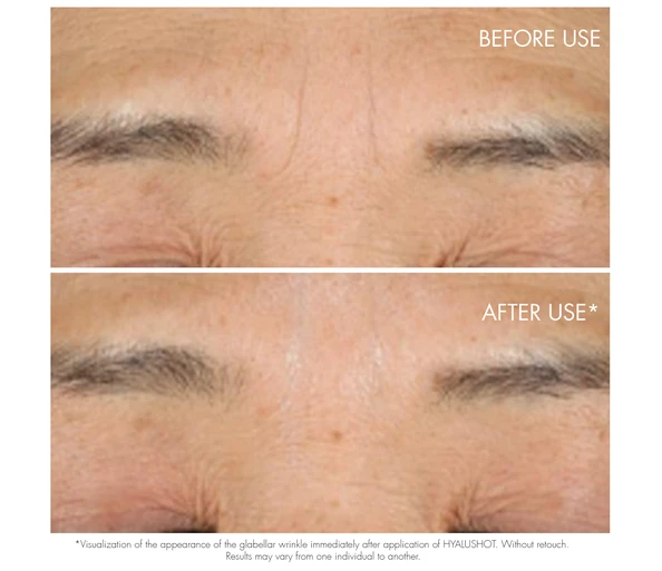 DIOR Capture Totale Hyalushot