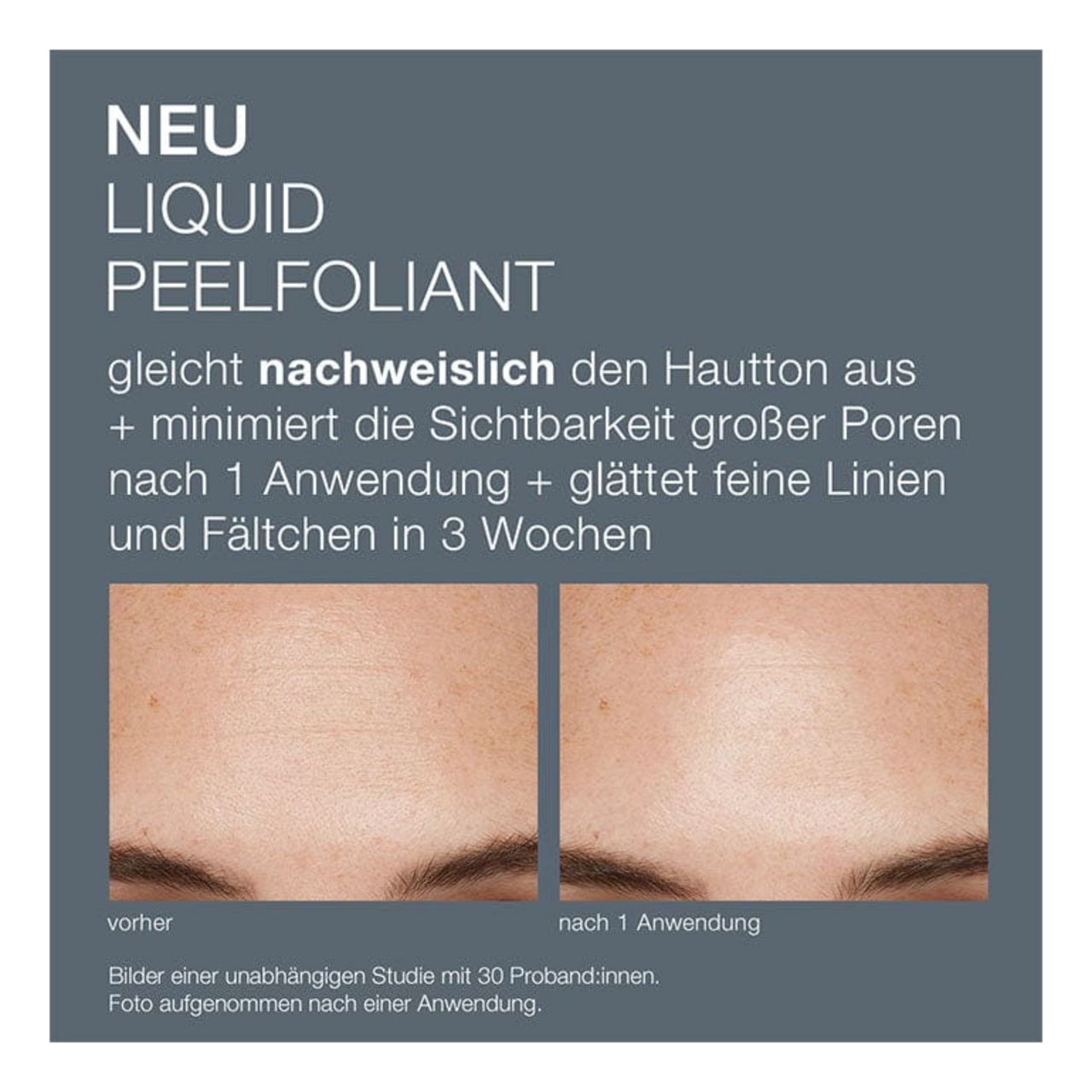 dermalogica Peelings Liquid Peelfoliant
