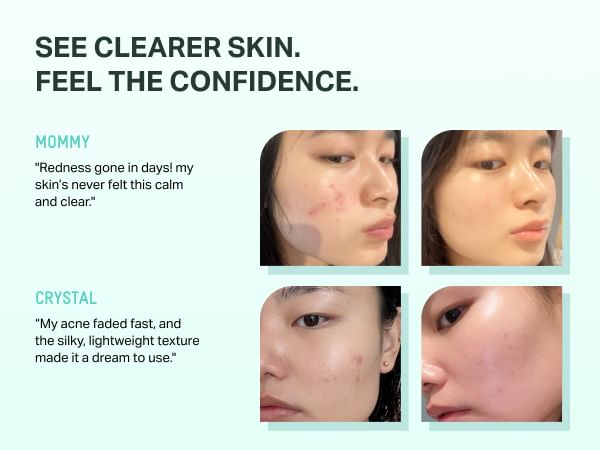 BRENG GROEN - Zinc Teca Blemish Serum
