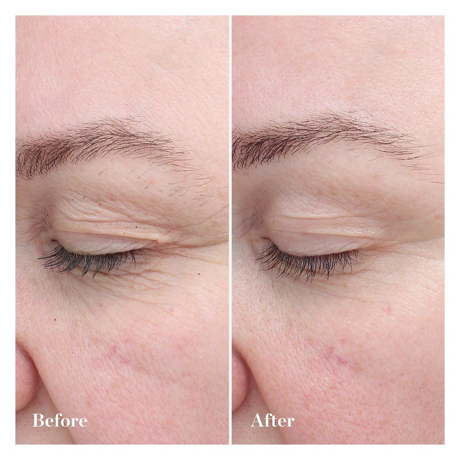 BIOEFFECT EGF Eye Serum 6ml