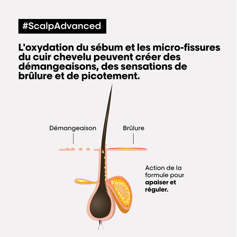 Coffret apaisant Scalp Advanced