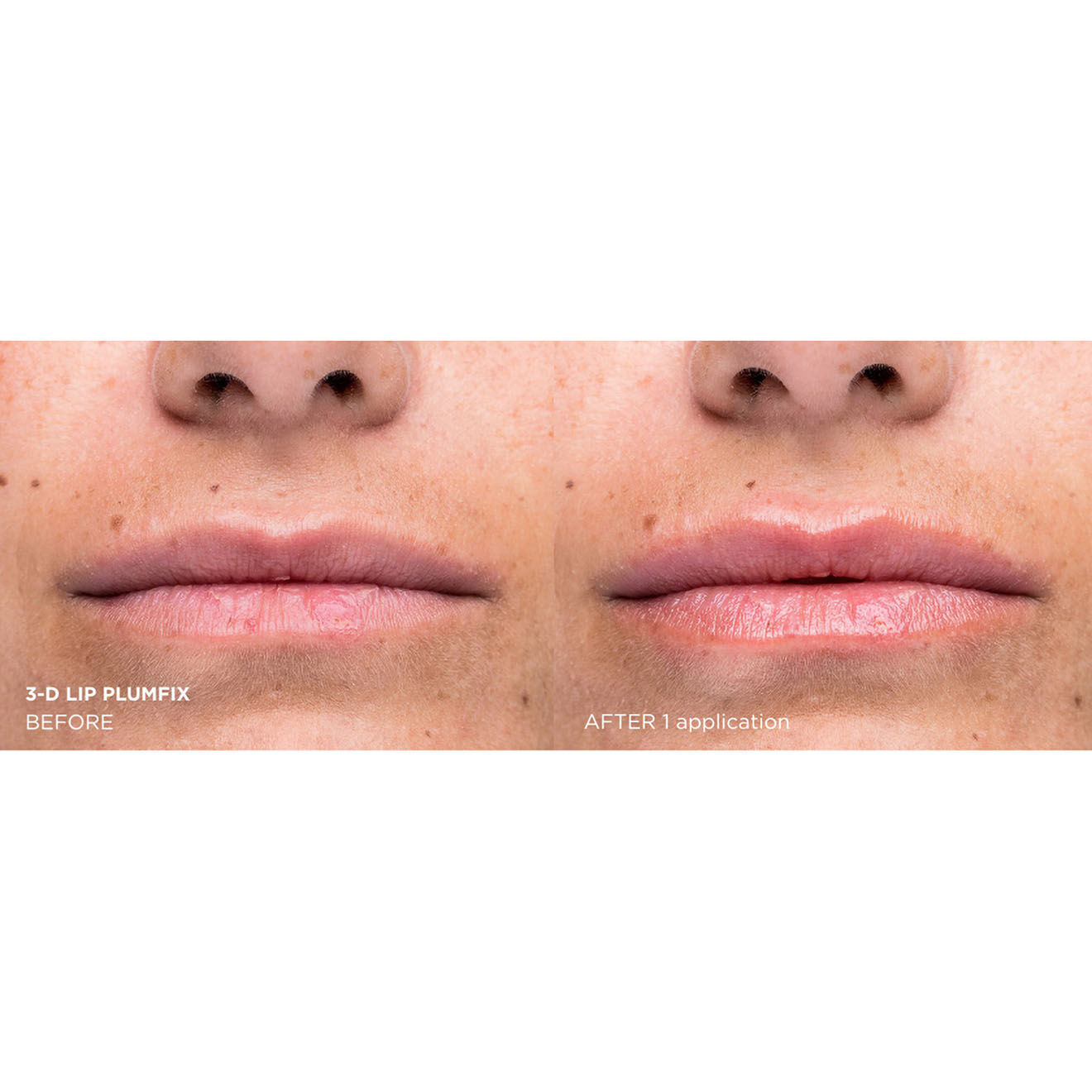 Dr. Brandt Plumpfix 3D Repulpant et hydratant Lèvres Needles no More - 5g