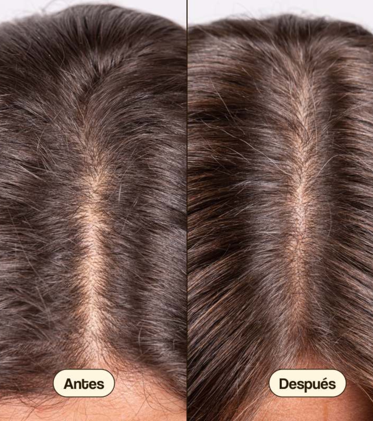 Freshly Cosmetics - Tratamento anti-queda de cabelo Hair Growth & Density