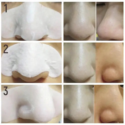 Milky Piggy Black Head 3 Step Solution