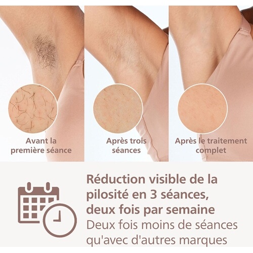 Epilation semi-définitive Philips Lumea série 8000 SenseIQ BRI945