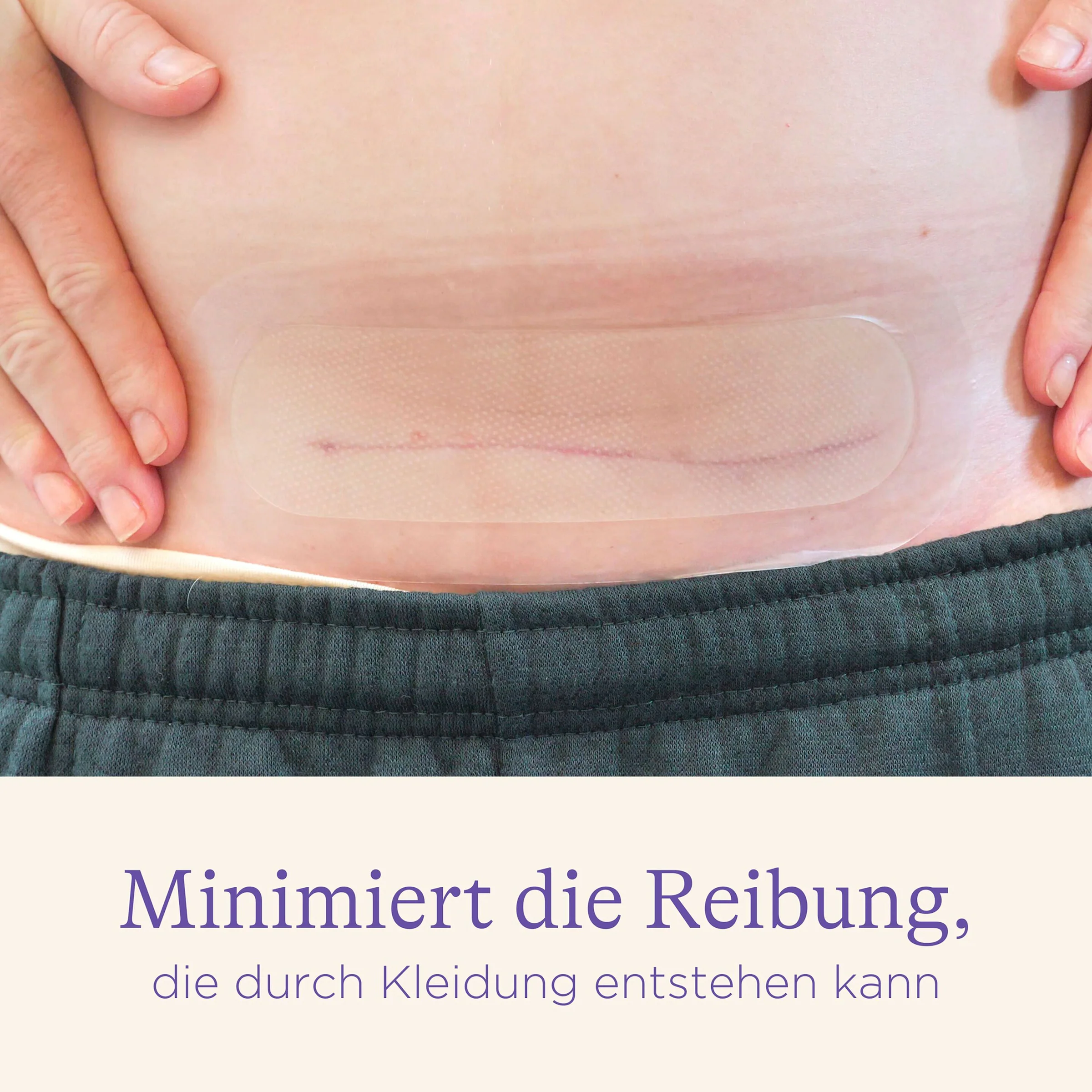Lansinoh 2er-Pack Kaiserschnitt Hydrogel-Pads