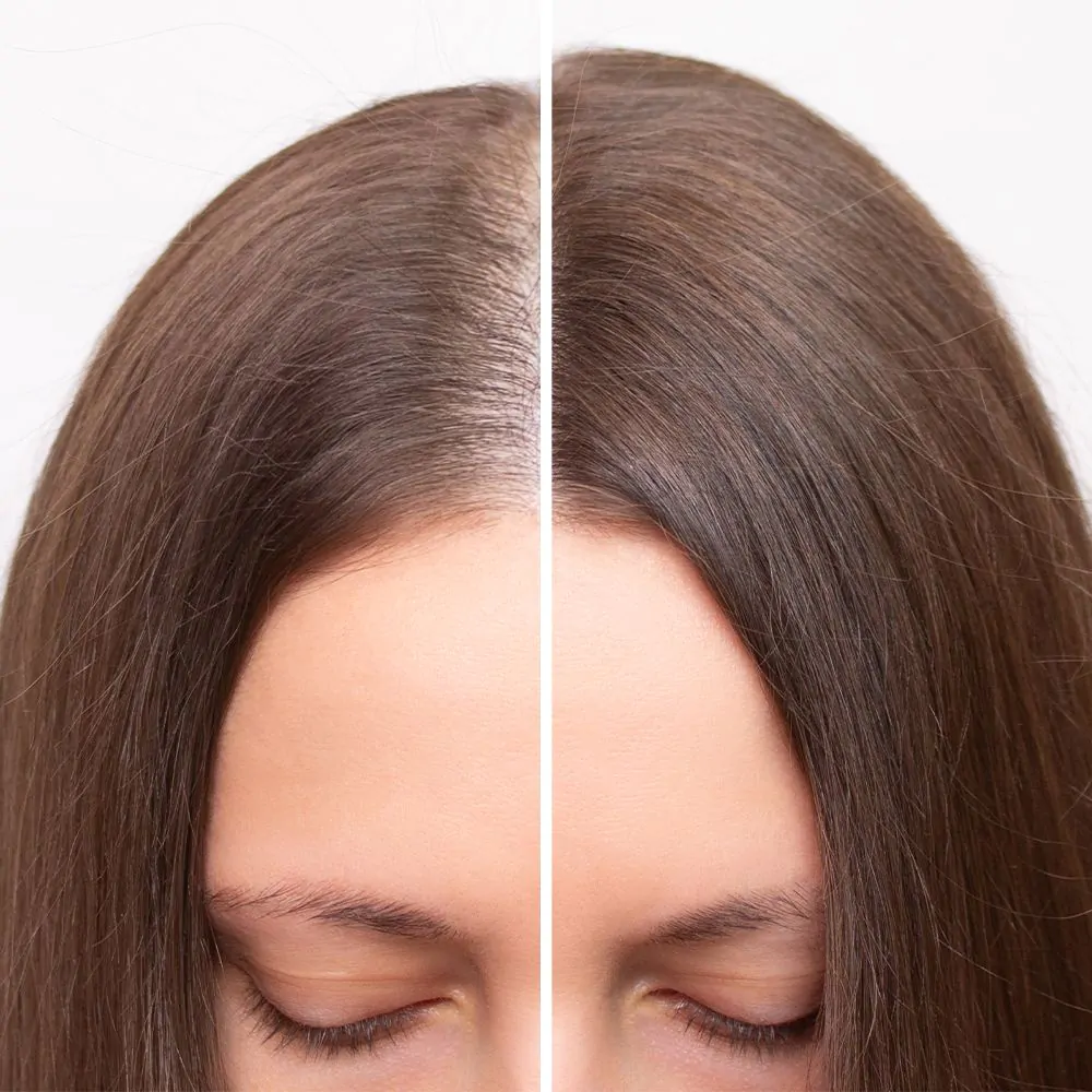 Shampoo bij Haaruitval 200 ml