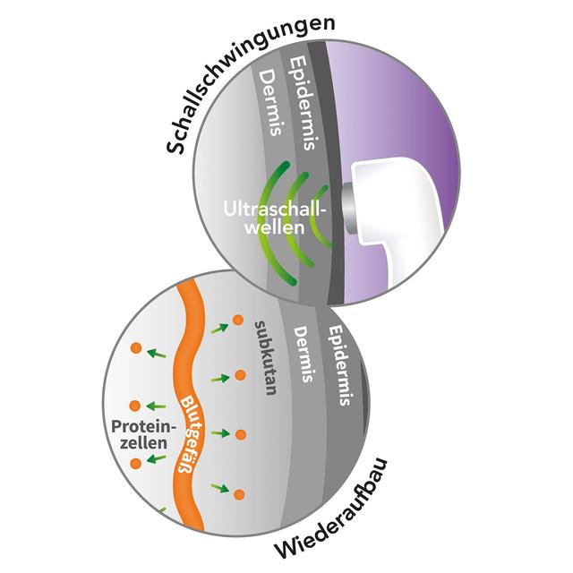 REVITIVE Ultraschalltherapie