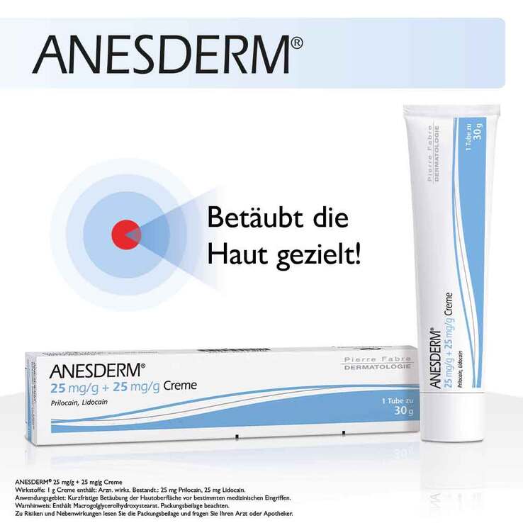 ANESDERM 25 mg/g + 25 mg/g Creme, 30 g