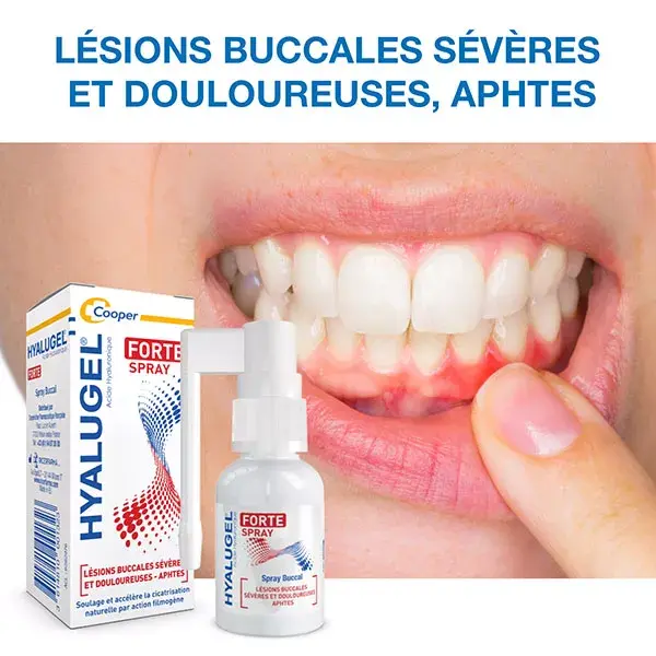 Gel oral Hyalugel para lesões bucais graves e dolorosas, tubo de 8 ml