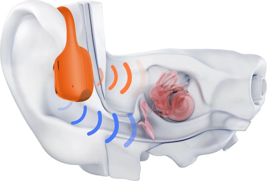 Shokz Open Run Pro 2 Mini Orange Écouteurs Bluetooth