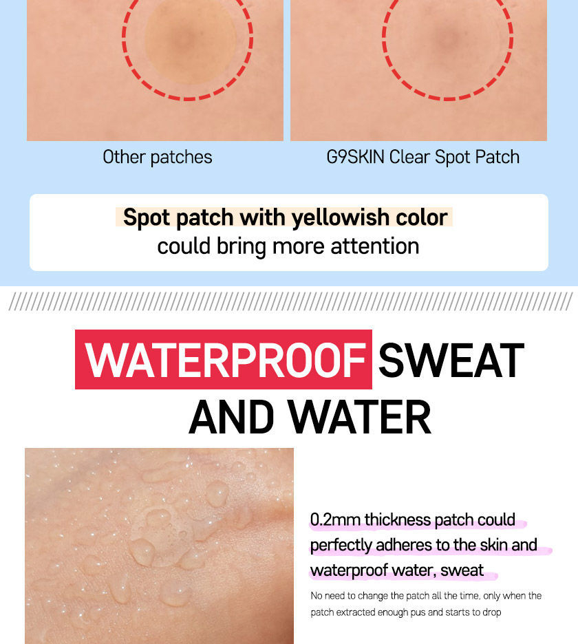 G9SKIN - Zero Solution Spot Cover Patch 108 stuks