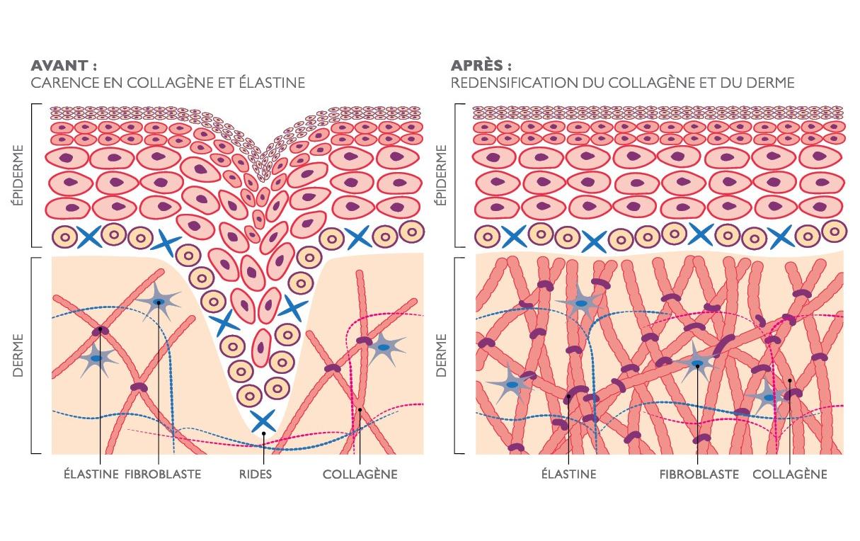 Antiaging-Gerät FaceTite Revive Cordless Weiss<br>Hautverjüngungs Gerät ohne Kabel
