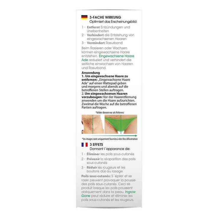 Biomed eingewachsene Haare ade Creme, 90 ml