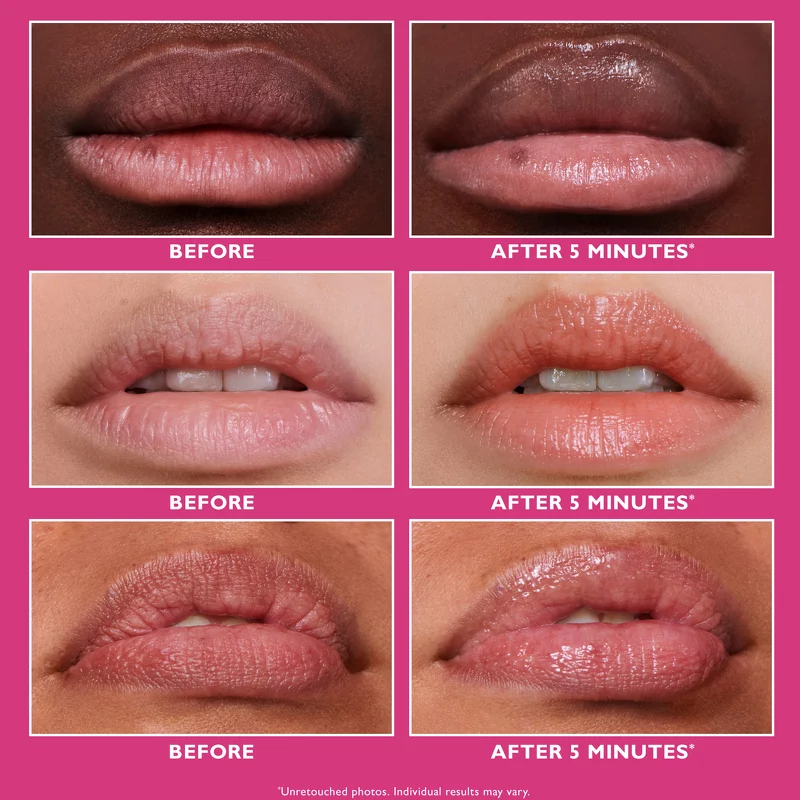 Peter Thomas Roth Instant FIRMx® Lip Filler 10 ml
