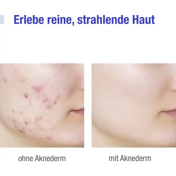 Getönte Tagespflegecreme mit Lichtschutzfaktor
