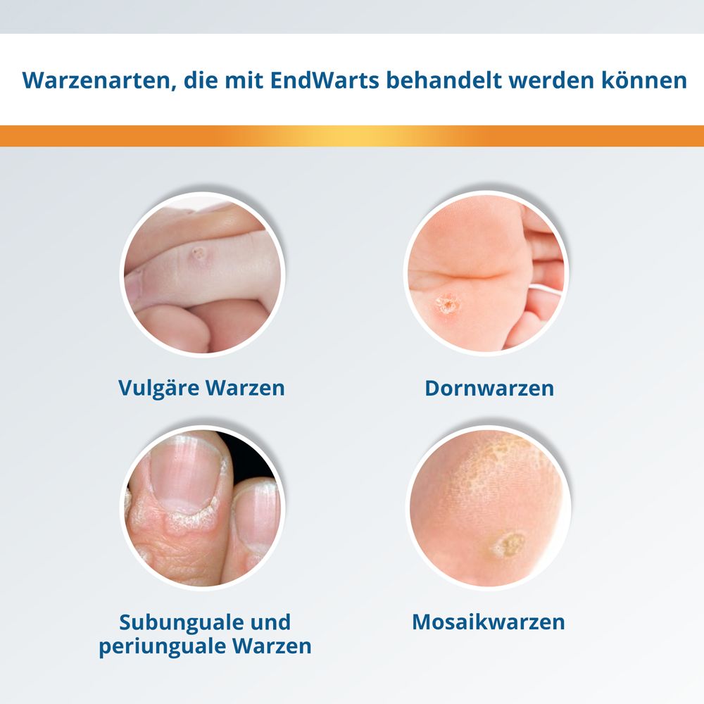 EndWarts PEN F: Warzen entfernen, Warzenentferner mit Ameisensäure, zur Warzenentfernung, Stift für ca. 30 Behandlungen