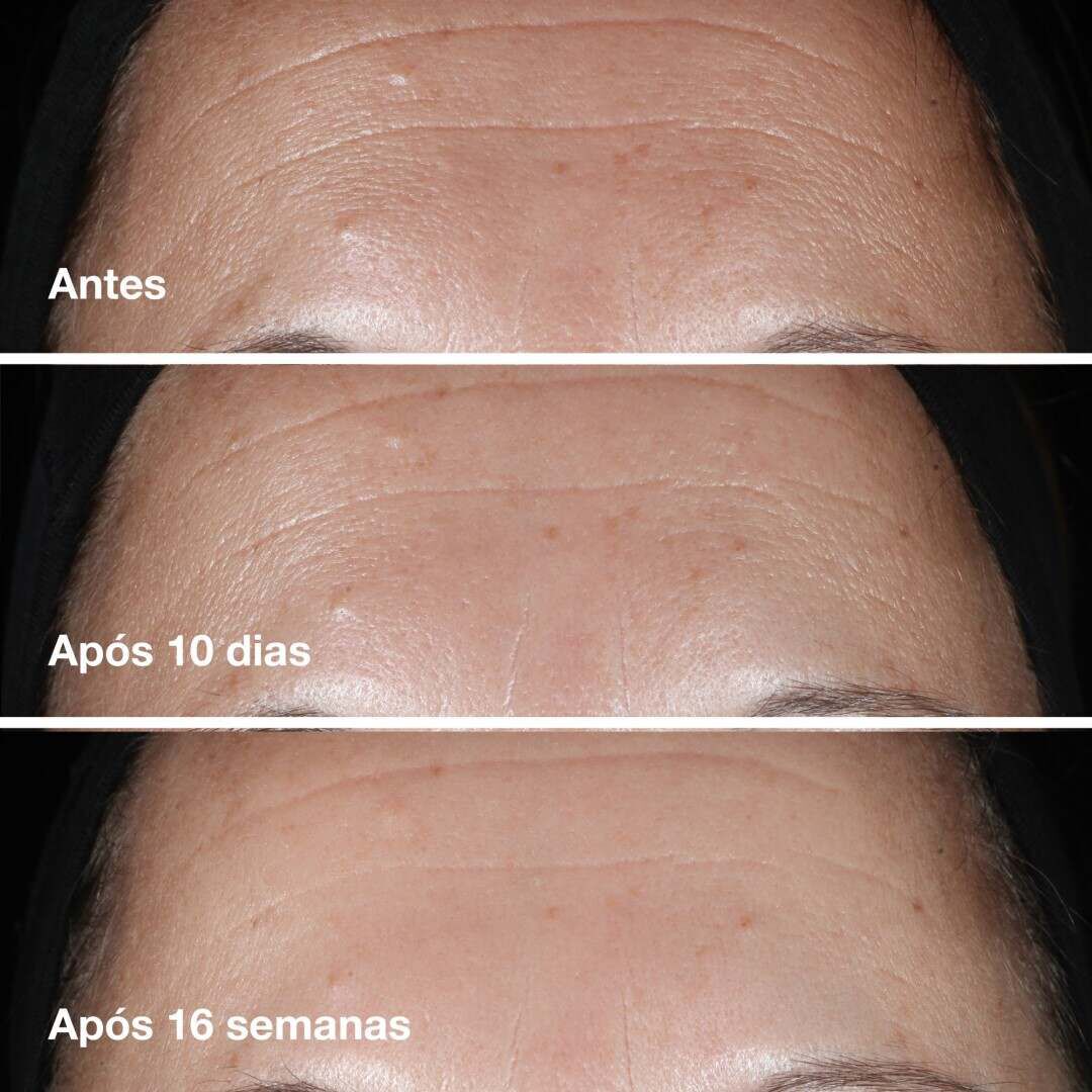 Smart Clinique Smart Clinical Repair™ Wrinkle Correcting Serum - 100ml