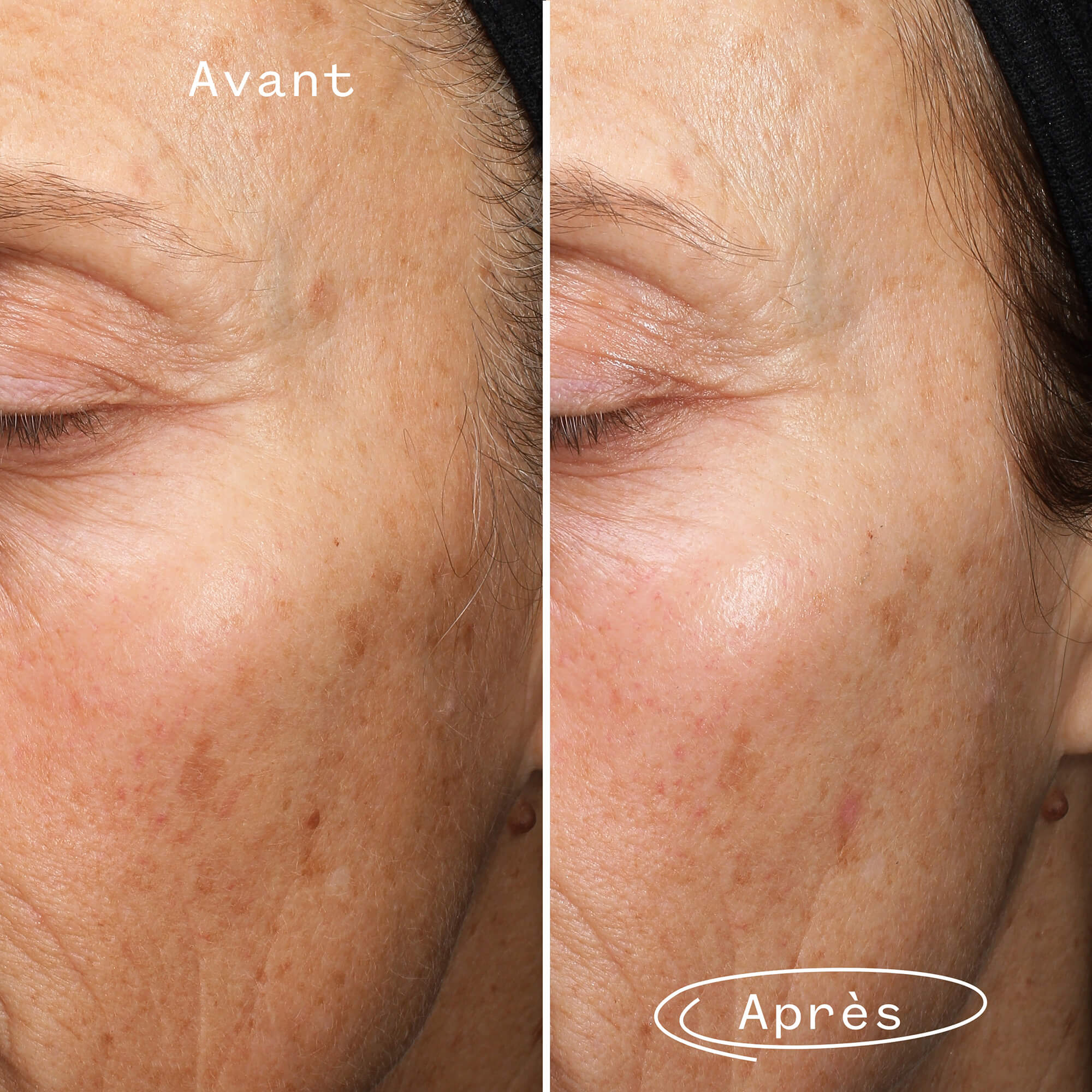 Pai Skincare Fade Forward Sérum Anti-Taches