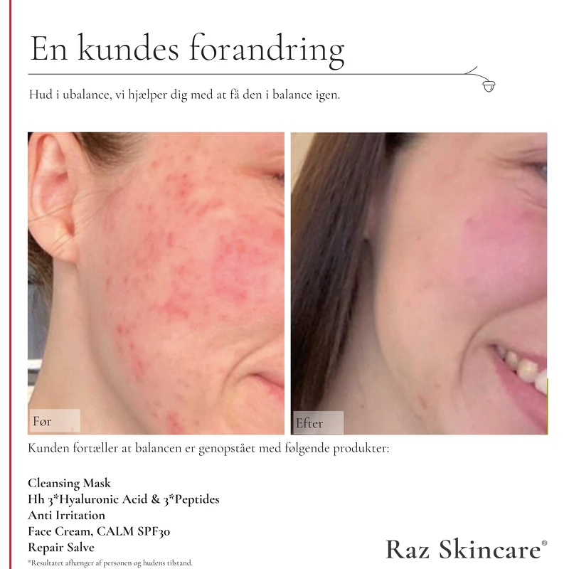 Raz Skincare Repair 15 ml