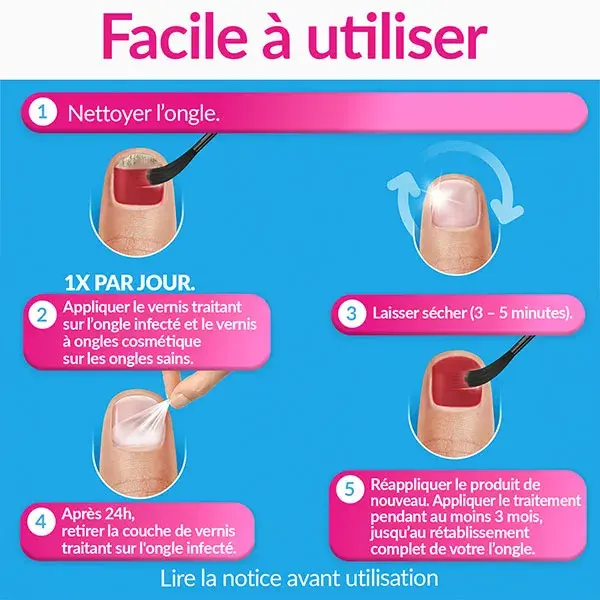 Excilor Strong Tratamento para Micose de Unhas Cor Vermelho Coral