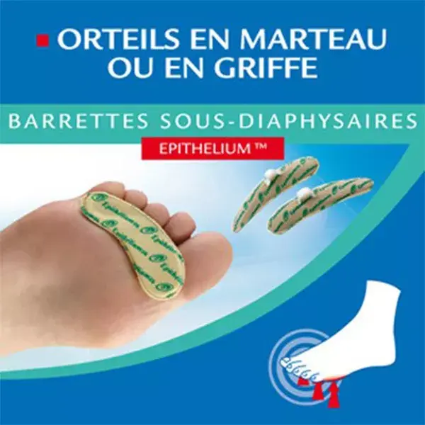 Epitact Barrettes Sous Diaphysaires Epithelium Homme