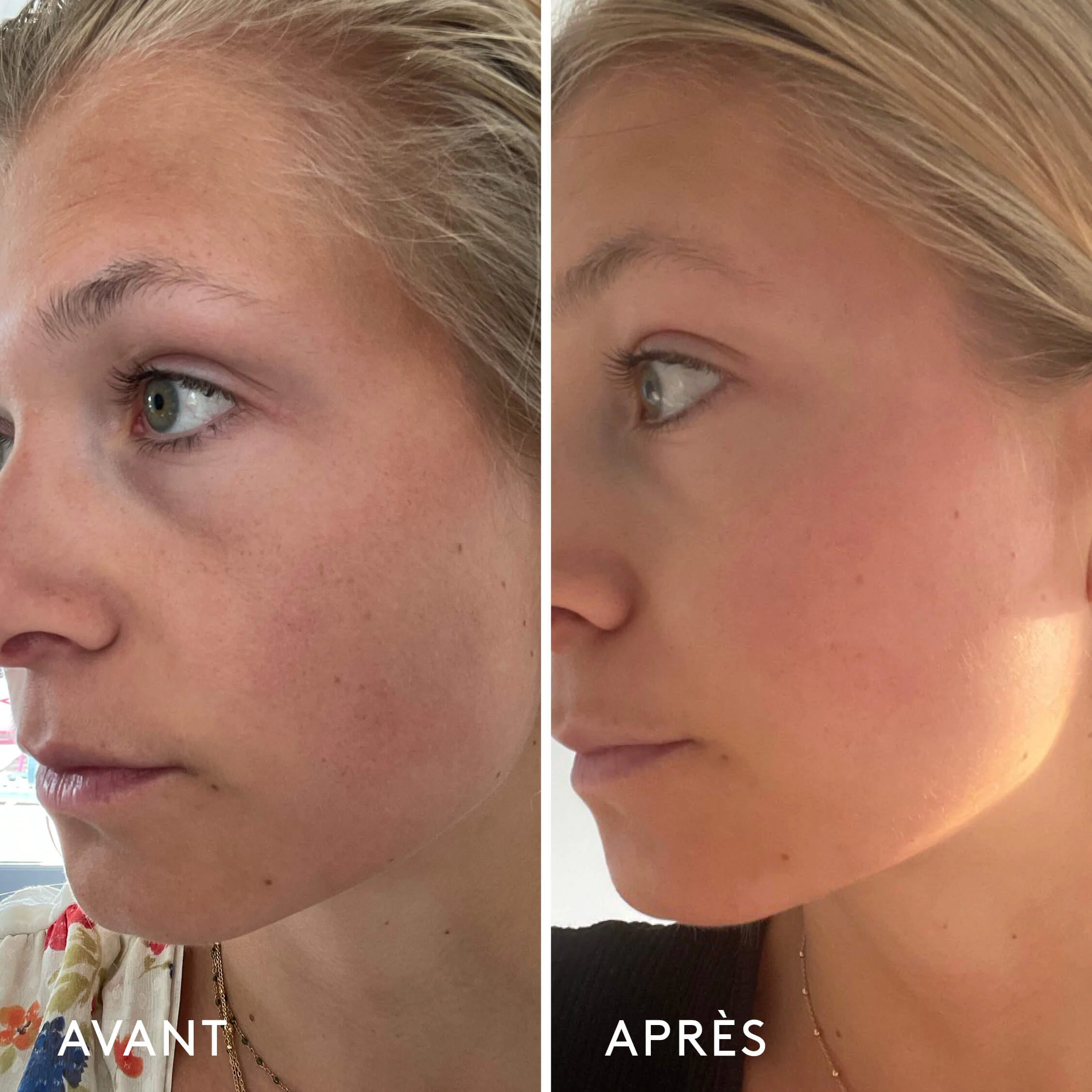 Oh My Cream Skincare Complément Alimentaire Repulpant