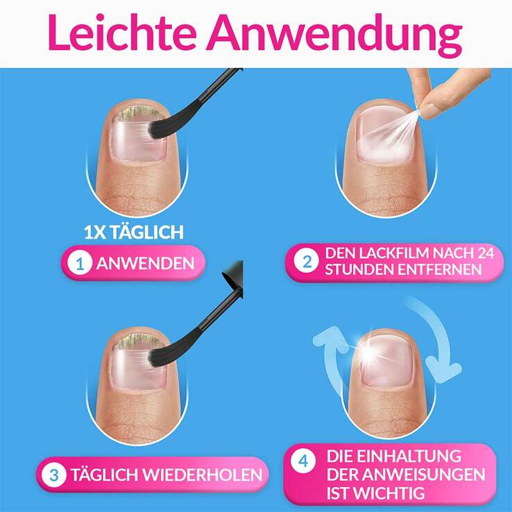 excilor INTENSIV Lack gegen Nagelpilz, 30 ml