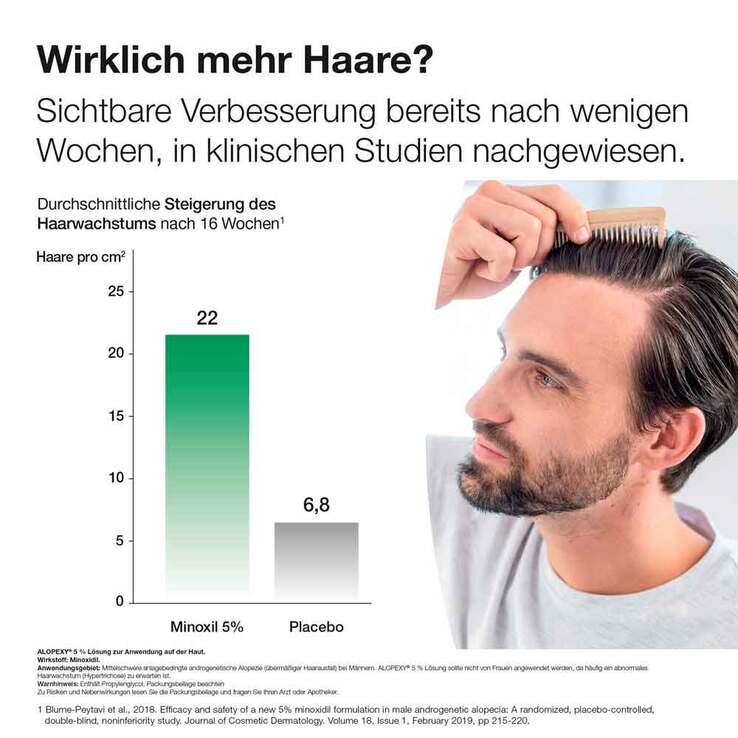 Alopexy 5% Lösung, 3X60 ml