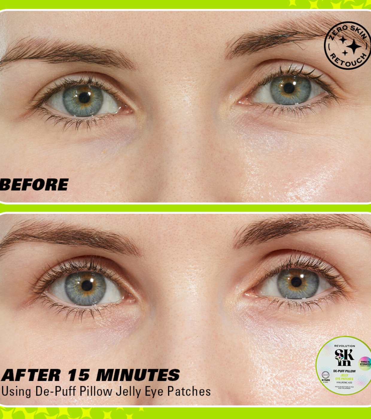 Revolution Skin - Adesivos de hidrogel para os olhos com ácido hialurônico Jelly De-Puff Pillow